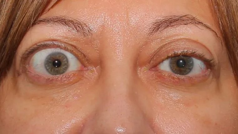 Qué hace único al Subaru Impreza Bug Eyes en el mundo automotriz 4 Qué hace único al Subaru Impreza Bug Eyes en el mundo automotriz